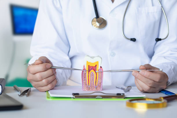 Best Emergency Wisdom Teeth Removal in Broussard, LA